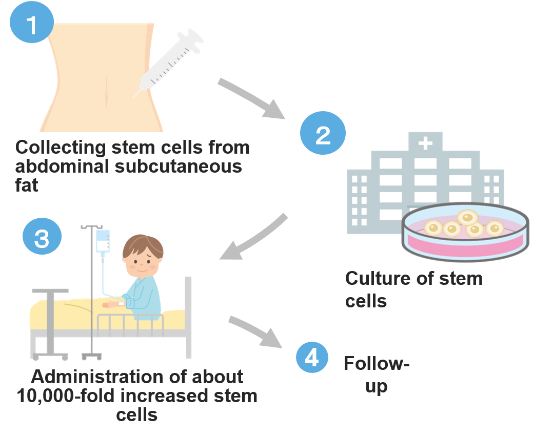 What is stem cell regenerative therapy? Detailed explanation of